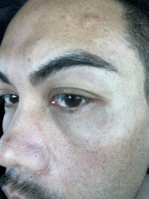 Eyebrow threading