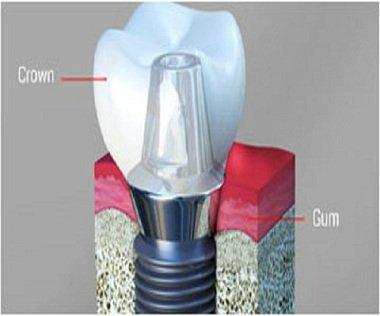 New Image Dental, LLC