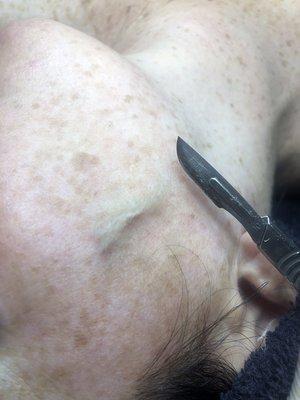 Dermaplaning Facial -this painless advanced service uses a blade to gently graze the skin to remove peach fuzz and reveal soft glowing skin!