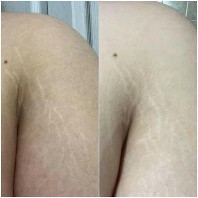 Wow! Amazing results with just one session