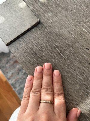 Ring finger and pointer uneven