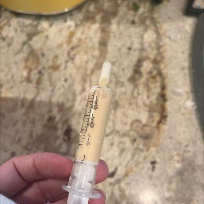 disgusting yellowed rotten antibiotic for my 5year old child because the told us it didnt need to be refrigerated when it did.