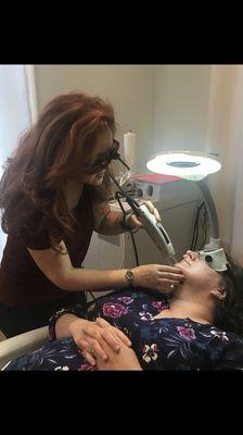 Laser Hair Removal of the face.