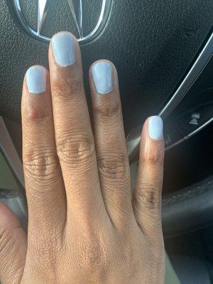 Terrible shaped nails and patchy color