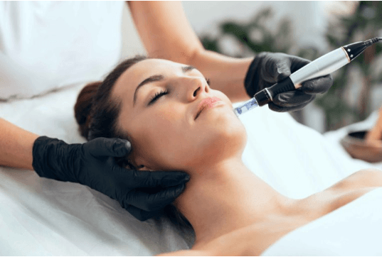 Microneedling