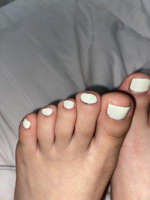 The toe next to the big toe is the one she put acrylic clearly not a square shape the polish is also tacky