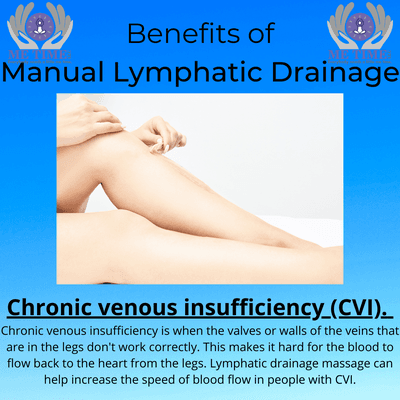 MLD can help if you suffer from CHronis Venous Insuffuciency (CVI).