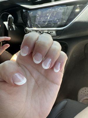 misshaped nails, not even and bumpy