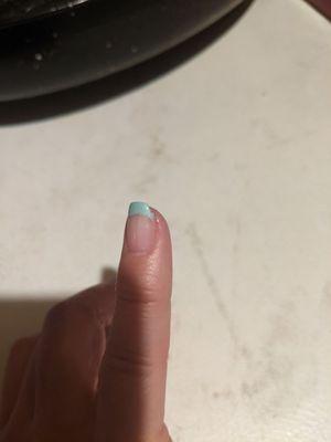 Broken pinky nail