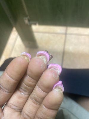 My real nail is so attached to the acrylic that it was pulling it upward  ripping my nail bed I have to go get these soaked off asap