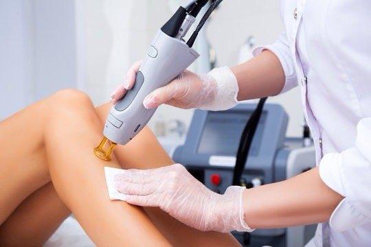 Laser hair removal