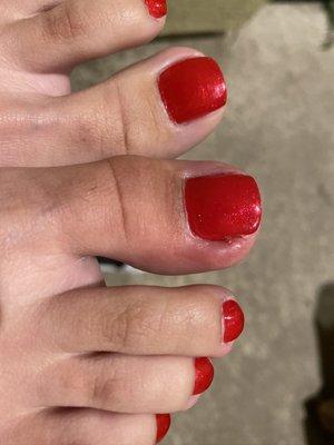 Pedicure gone bad. she was trying to remove an ingrown nail I didn't have in the first place and made me bleed. now it's infected