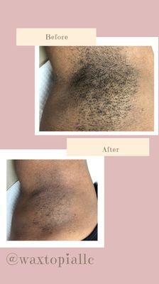 Female Underarm Wax