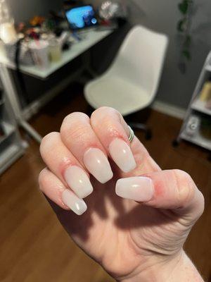 Enflamed cuticles.