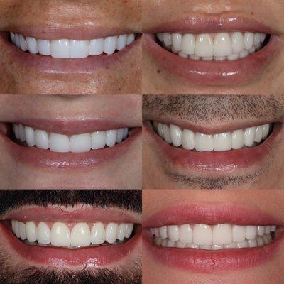 The New York Center For Cosmetic Dentistry-Dr Emanuel Layliev