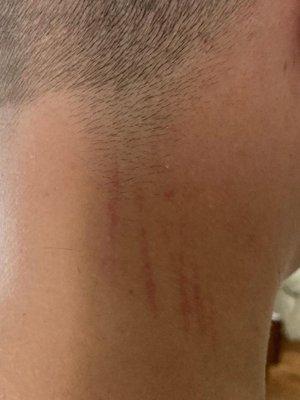 Haircut with marks left by hairdresser