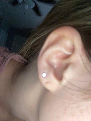 2nd lobe