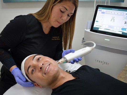 POTENZA RF Microneedling with PRP enhancement