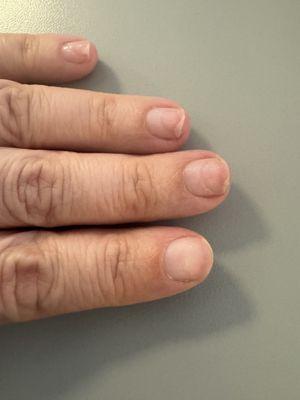 Left hand- expected all nails to look like this.