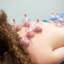 Cupping helps alleviate chronic muscle tension