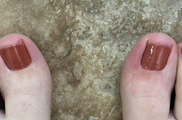 Right toe compared to left... they are SO SHORT too!!