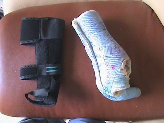 ExpressCare rip-off. Left, $100 velcro splint cost $65 to apply from ExpressCare. Right, cast, cost $95.12 to apply from Ortho Doc.