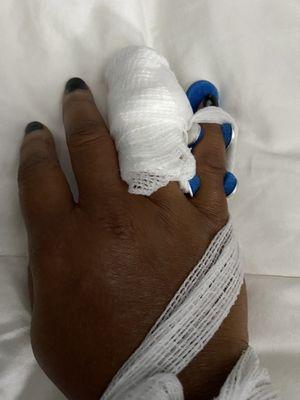 Right hand injury. Picture taken at hospital