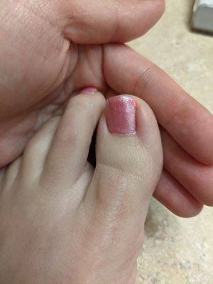 White buildup at base of nail, it's flaky and really shouldn't be on a fresh set of toes!