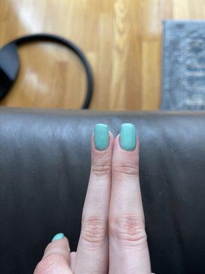 Crooked uneven nails