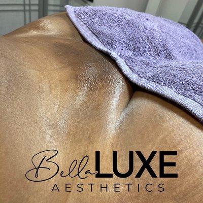 Bella Luxe Aesthetics