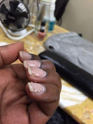 After they tried to soak the acrylic off and it didn't work