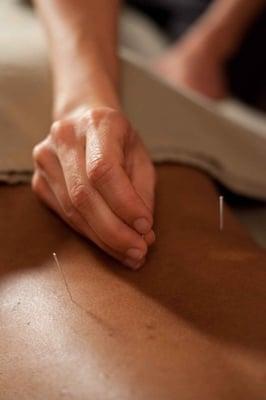 Julie Festa Acupuncture