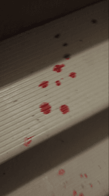 Blood on stairs