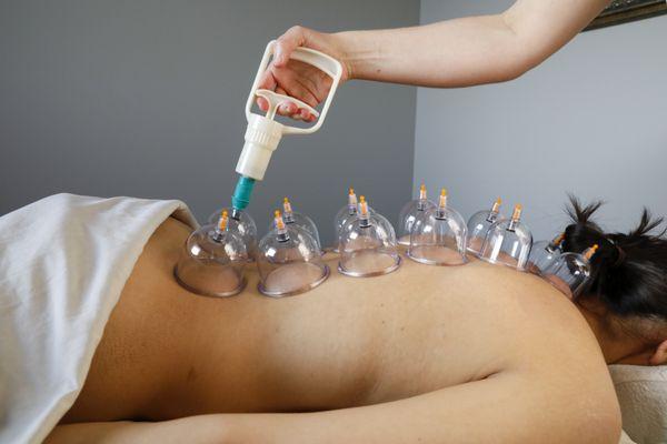 Suction cupping massage is great for pain relief, detox, and increasing your immune system.