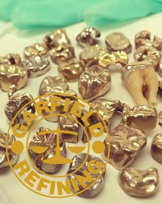 Dentist Precious Metals