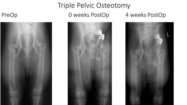 Triple Pelvic Osteotomy