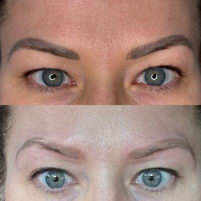 Top pic is layers of old permanent makeup  Bottom pic is 60 seconds later after laser tattoo removal.