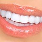 Lumineers and veneers are ideal for improving your smile's appearance.