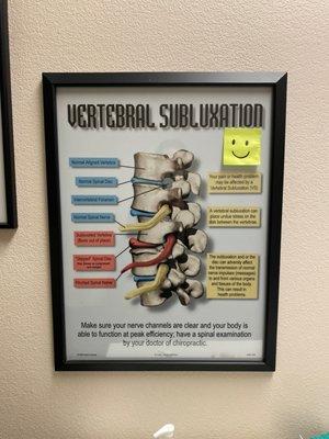 Vertebral subluxation