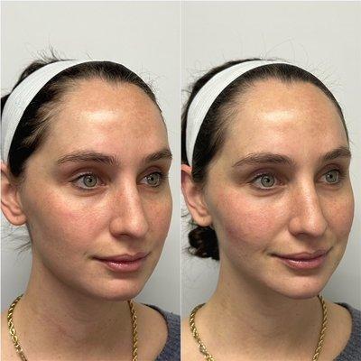 Facial Balancing