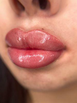 lip blush on lips with fillers