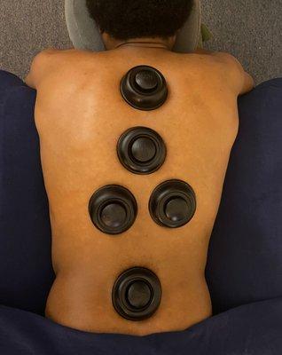 Cupping Massage Therapy Back Massage - Suction Technique