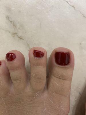 Thanks for chopping off my second toe's nail and making it look stupid.