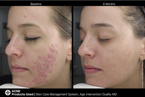 Amazing results you can trust from Jan Marini skin research