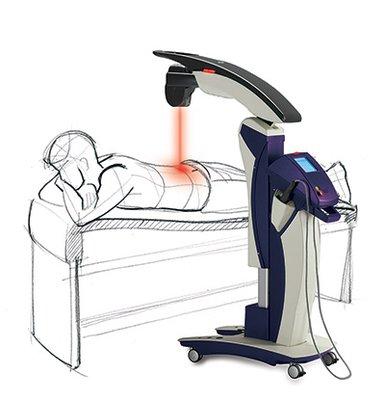 Class 4 Robotic MLS Laser