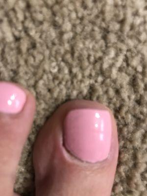 Cut cuticle. The polish was good just not so much on the bleeding part.