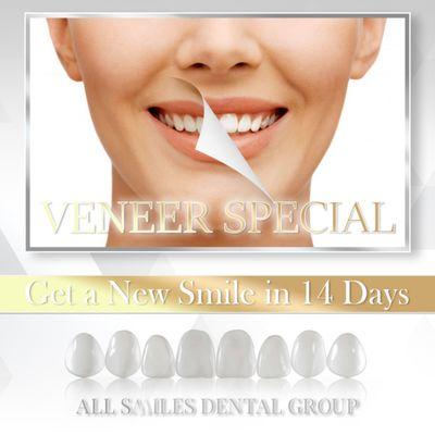 Viva Veneers !!!