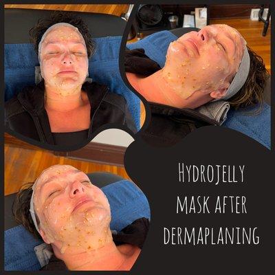 Dermaplaning