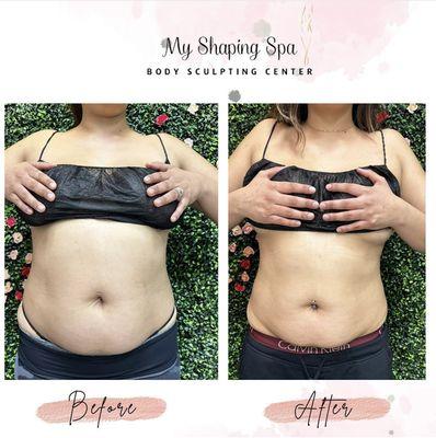 Results with our The Shaping Method