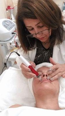 Microneedling